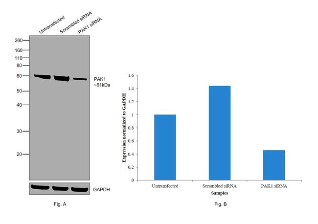 PAK1 Antibody in Western Blot (WB)