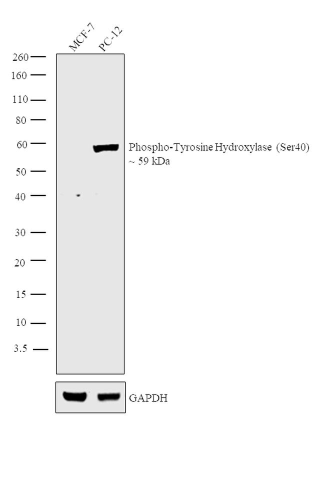 Phospho-Tyrosine Hydroxylase (Ser40) Antibody in Western Blot (WB)