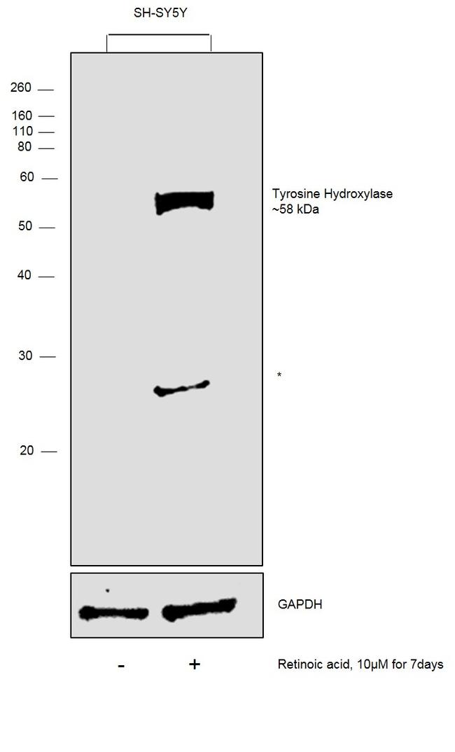 Tyrosine Hydroxylase Antibody in Western Blot (WB)