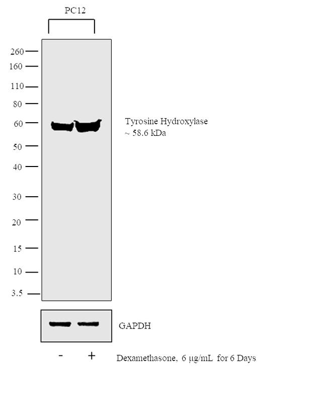 Tyrosine Hydroxylase Antibody