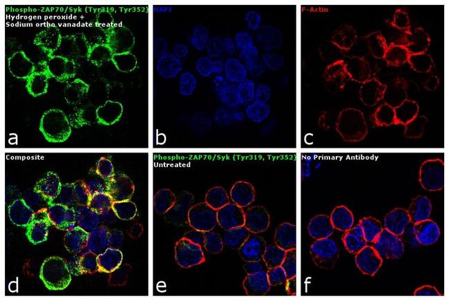 Phospho-ZAP70/Syk (Tyr319, Tyr352) Antibody