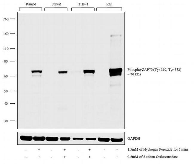 Phospho-ZAP70/Syk (Tyr319, Tyr352) Antibody