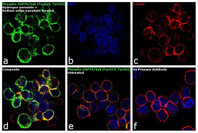 Phospho-ZAP70/Syk (Tyr319, Tyr352) Antibody in Immunocytochemistry (ICC/IF)