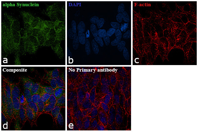 alpha Synuclein Antibody in Immunocytochemistry (ICC/IF)