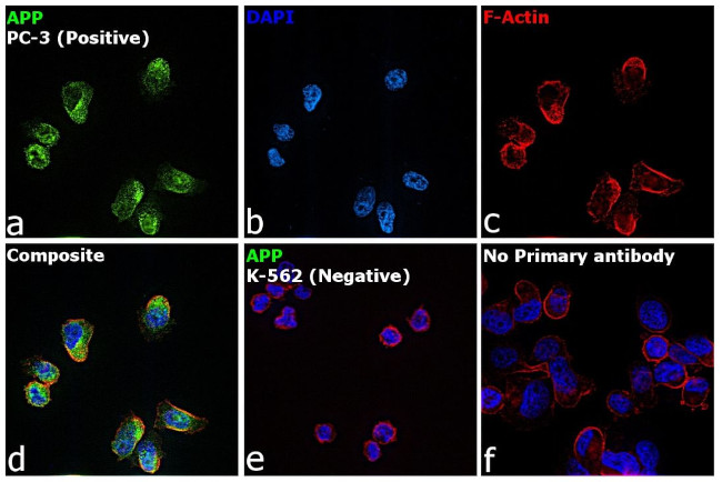 Amyloid Precursor Protein Antibody