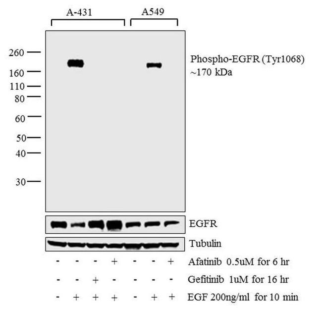 Phospho-EGFR (Tyr1068) Antibody