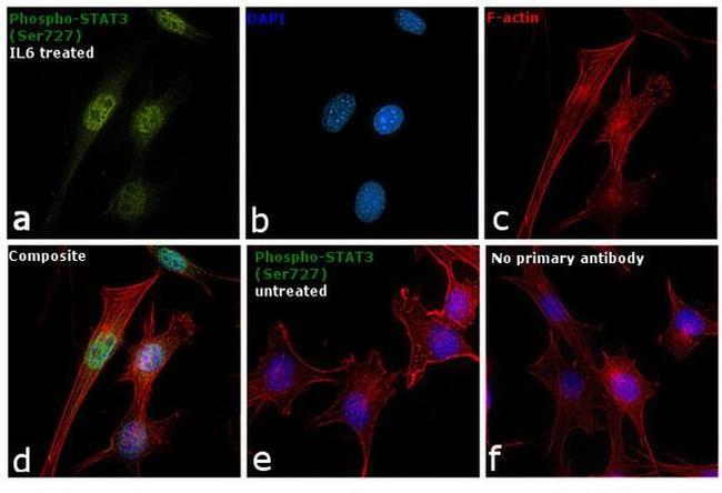 Phospho-STAT3 (Ser727) Antibody