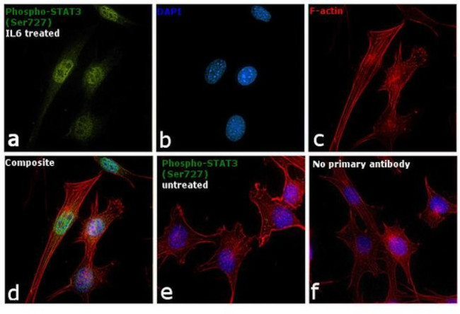 Phospho-STAT3 (Ser727) Antibody in Immunocytochemistry (ICC/IF)