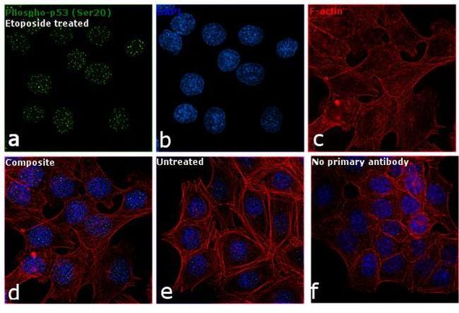 Phospho-p53 (Ser20) Antibody