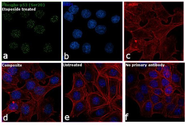 Phospho-p53 (Ser20) Antibody in Immunocytochemistry (ICC/IF)