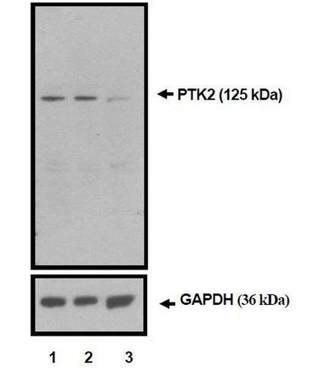 FAK Antibody in Western Blot (WB)