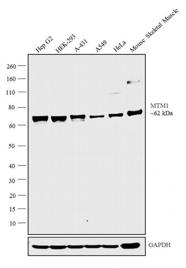 MTM1 Antibody in Western Blot (WB)