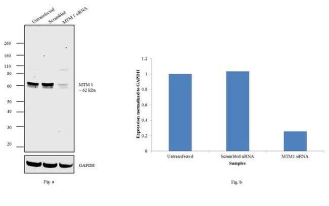 MTM1 Antibody in Western Blot (WB)