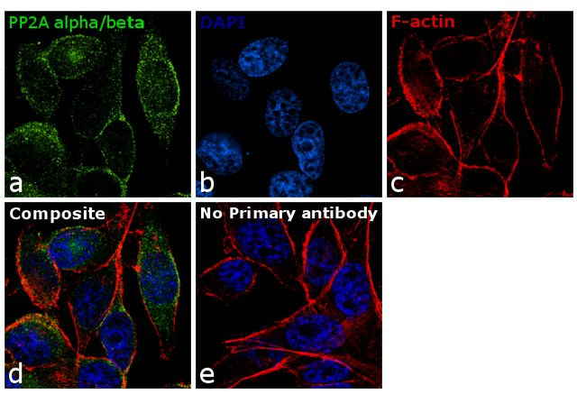 PP2A alpha/beta Antibody in Immunocytochemistry (ICC/IF)