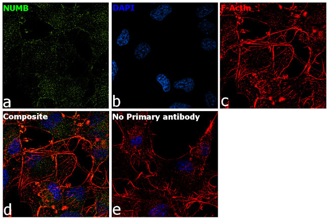 NUMB Antibody in Immunocytochemistry (ICC/IF)