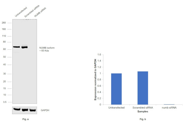 NUMB Antibody