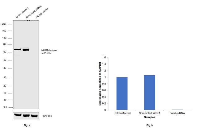 NUMB Antibody in Western Blot (WB)