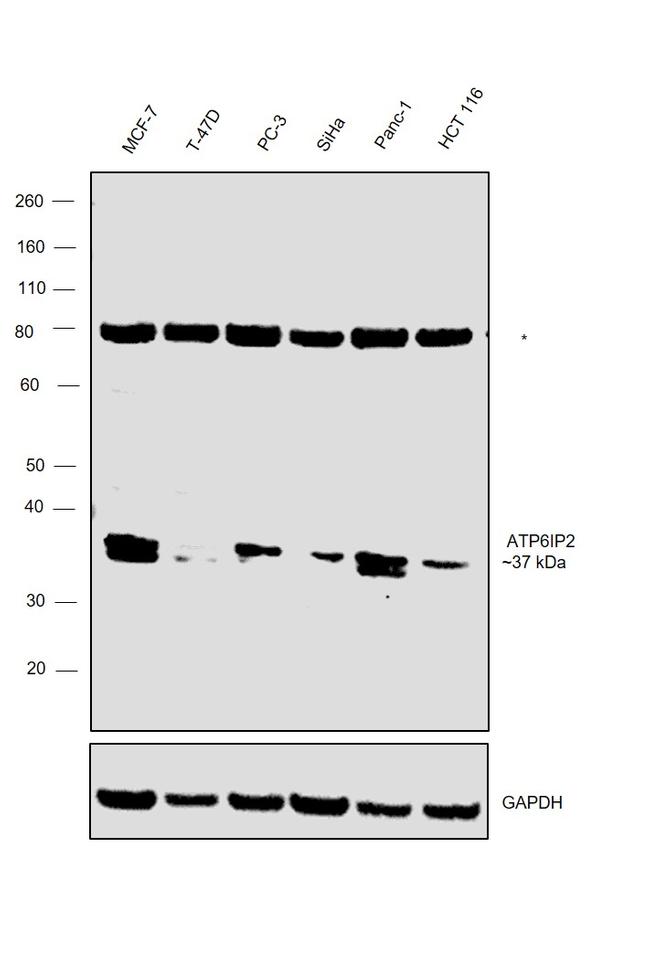 ATP6IP2 Antibody in Western Blot (WB)