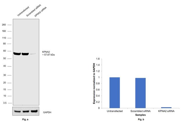 KPNA2 Antibody in Western Blot (WB)