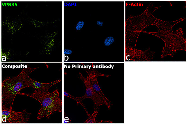 VPS35 Antibody in Immunocytochemistry (ICC/IF)