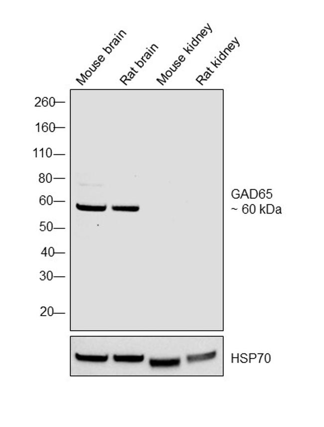 GAD65 Antibody in Western Blot (WB)