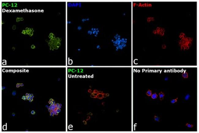 Tyrosine Hydroxylase Antibody