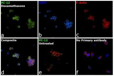 Tyrosine Hydroxylase Antibody in Immunocytochemistry (ICC/IF)