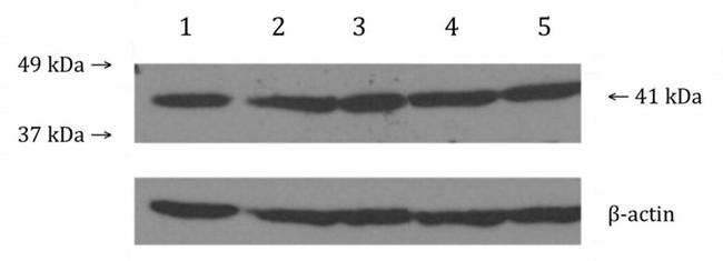 CNR2 Antibody in Western Blot (WB)