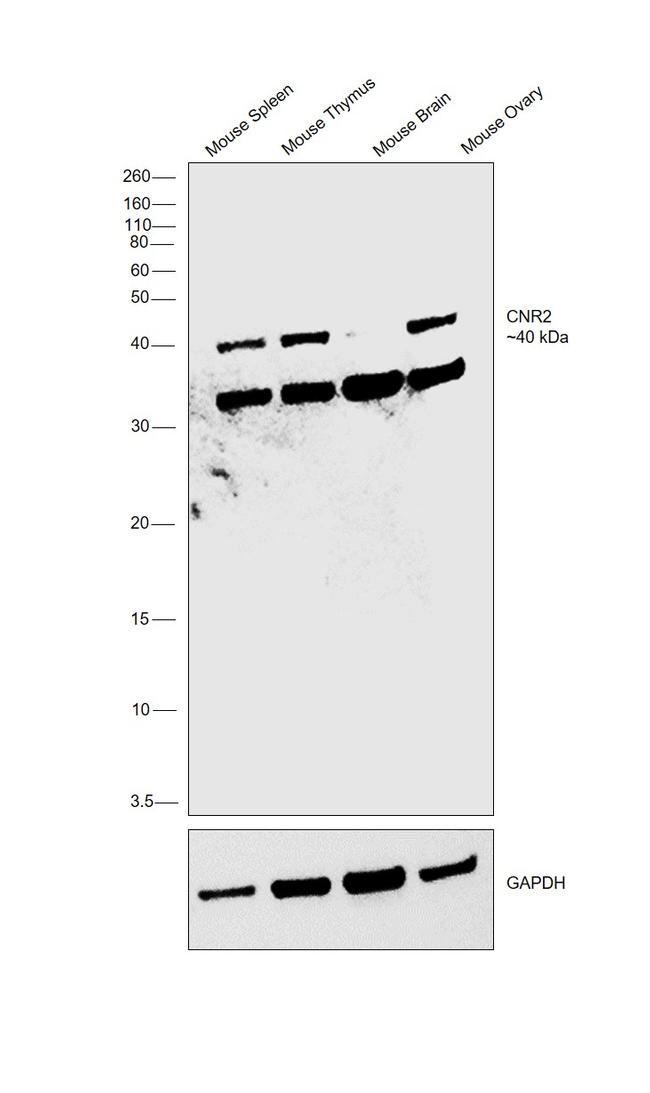 CNR2 Antibody in Western Blot (WB)