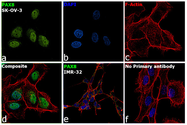 PAX8 Antibody in Immunocytochemistry (ICC/IF)