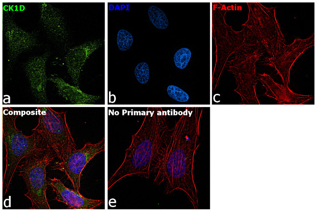 CK1 delta Antibody in Immunocytochemistry (ICC/IF)