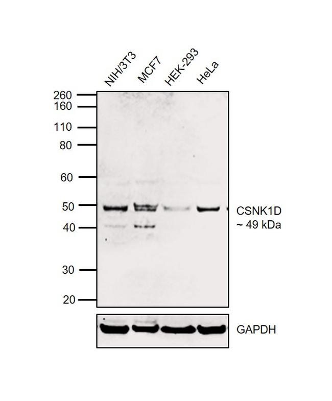 CK1 delta Antibody in Western Blot (WB)