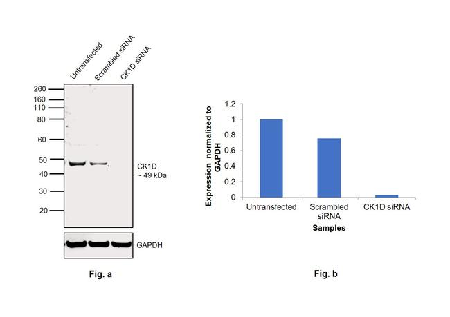 CK1 delta Antibody in Western Blot (WB)