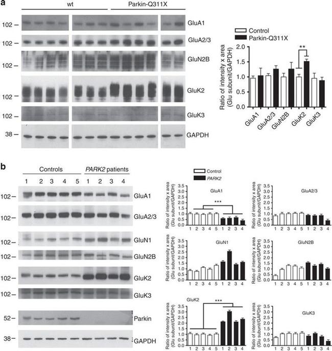 NMDAR2B Antibody in Western Blot (WB)