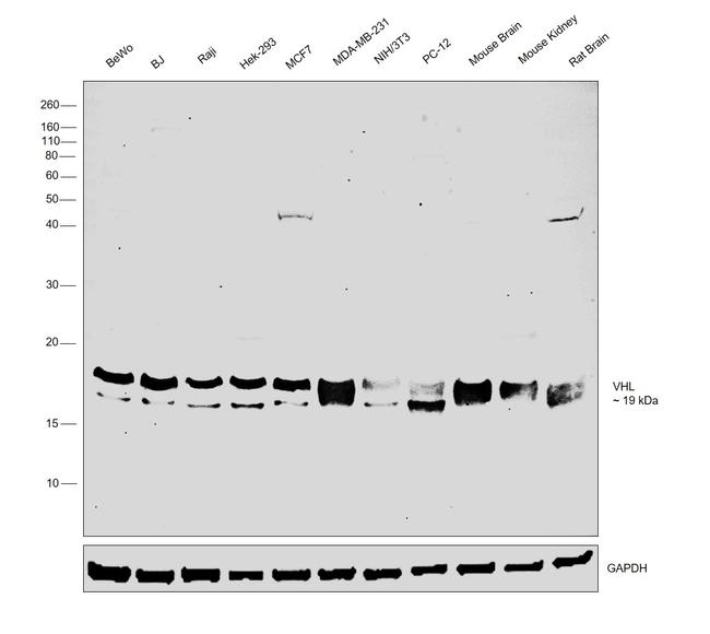 VHL Antibody in Western Blot (WB)