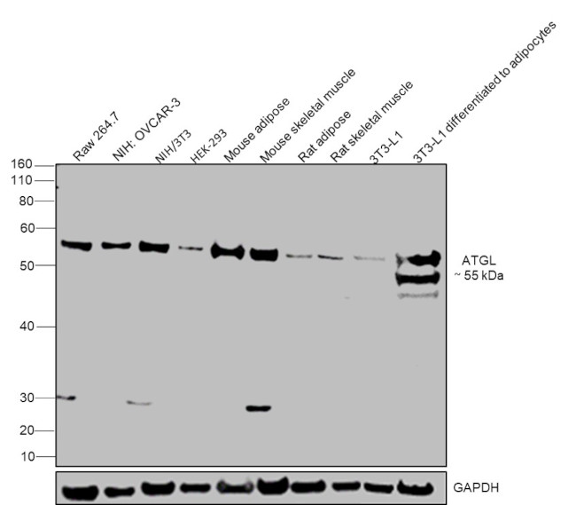 ATGL Antibody