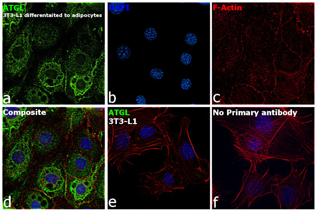 ATGL Antibody in Immunocytochemistry (ICC/IF)