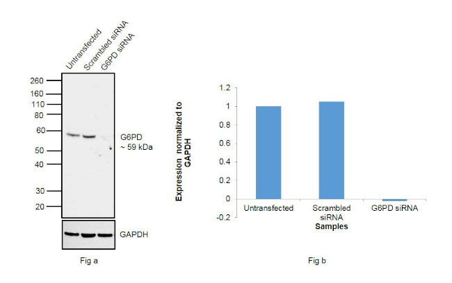 G6PD Antibody