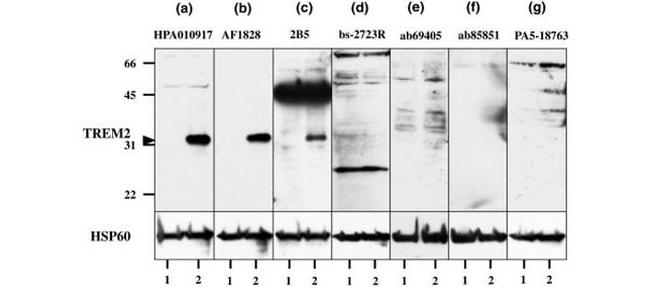 TREM2 Antibody in Western Blot (WB)