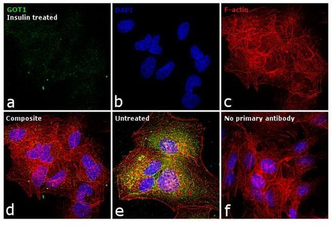 GOT1 Antibody