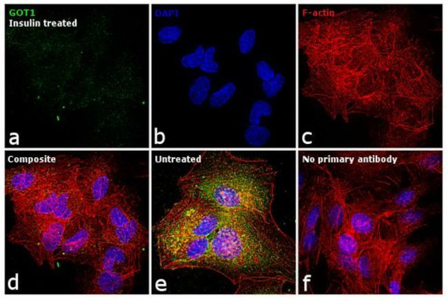 GOT1 Antibody in Immunocytochemistry (ICC/IF)