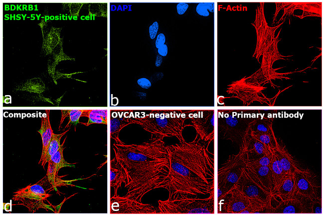 B1 Bradykinin Receptor Antibody in Immunocytochemistry (ICC/IF)