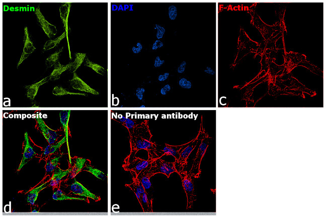 Desmin Antibody in Immunocytochemistry (ICC/IF)