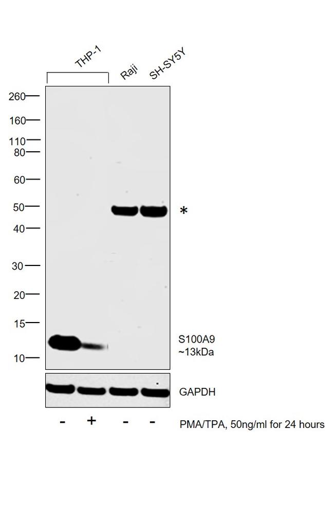 S100A9 Antibody in Western Blot (WB)