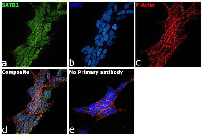 SATB1 Antibody in Immunocytochemistry (ICC/IF)