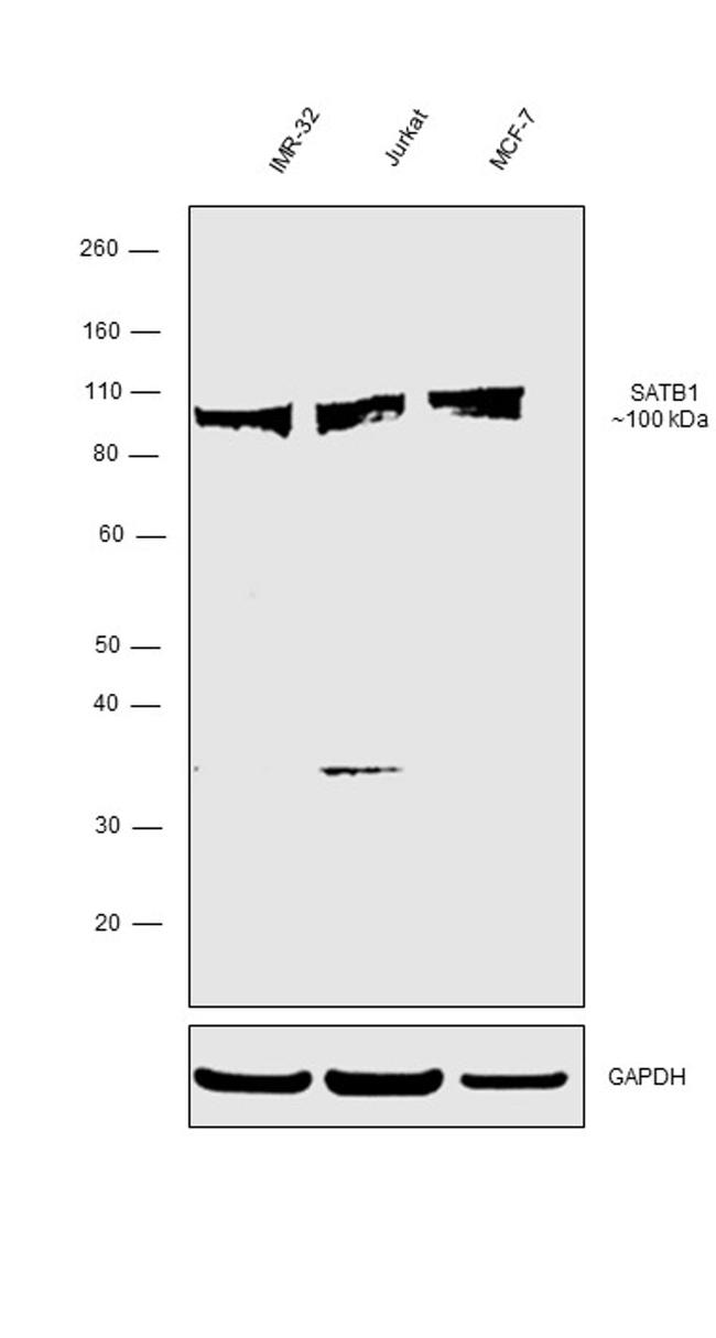 SATB1 Antibody in Western Blot (WB)