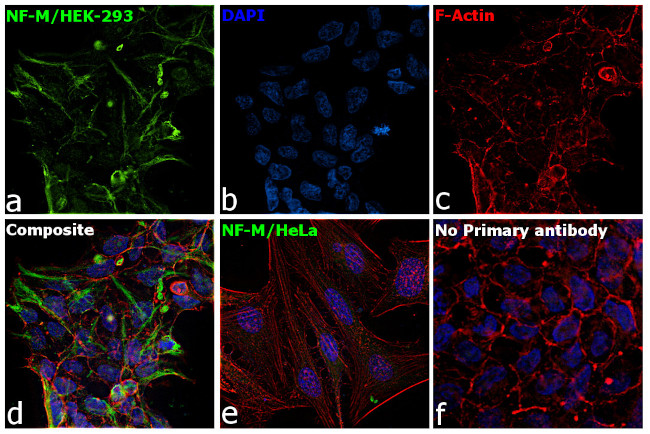 NEFM Antibody in Immunocytochemistry (ICC/IF)