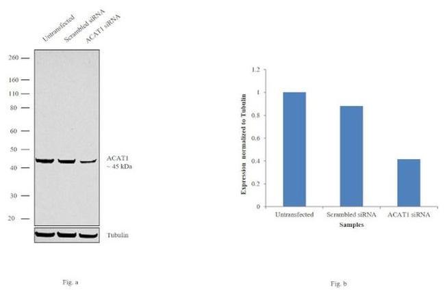 ACAT1 Antibody in Western Blot (WB)