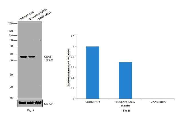 GNAS Antibody in Western Blot (WB)