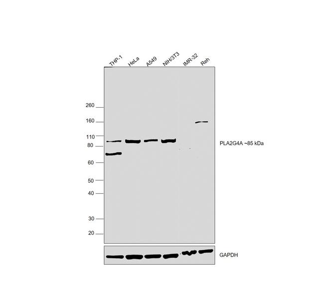 PLA2G4A Antibody in Western Blot (WB)